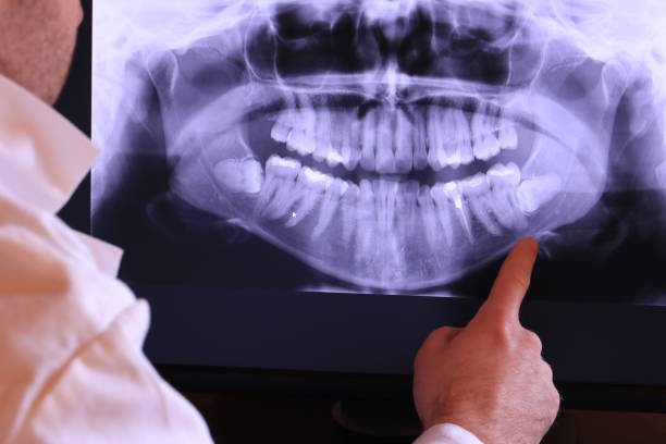 Best Dentist for Tooth Abscess  in Valhalla, NY